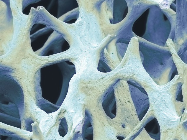 Nasce a Milano l’osso bionico che si stampa in 3D