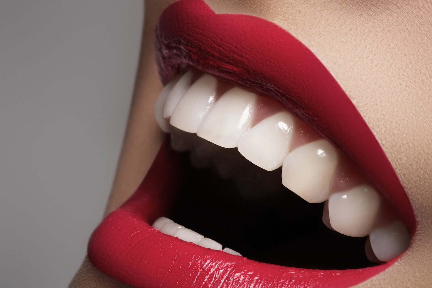 Denti bianchi: 16 rimedi naturali efficaci