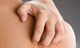 orticaria sintomi cause cure